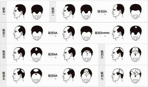 美食分享:玫瑰豉油鸡、鲜菇蛋花汤、麻辣牛肉片的简单做法“ky com”(图3) ky com